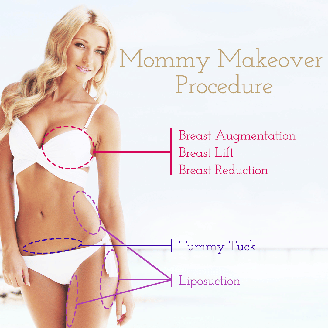 Mommy Makeover Surgery in Maryland Baltimore Mommy Makeovers