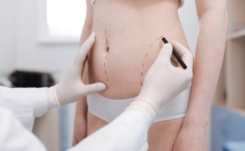 What Does Liposuction do?